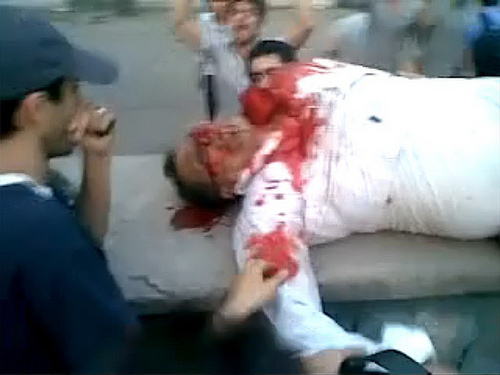 Another demonstrator who was injured and died during the demonstration on Saturday.