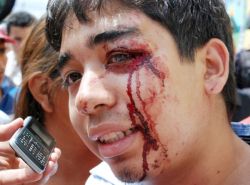 Estudiante herido, 30 de julio. Foto: Gilberto en Picasa.
